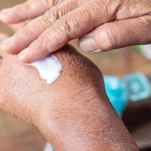 Topical scar treatment cream