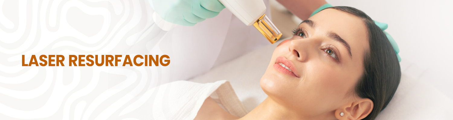 Laser Resurfacing