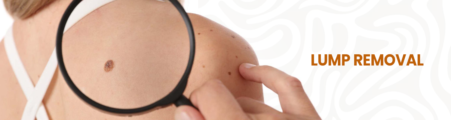 Lump Removal