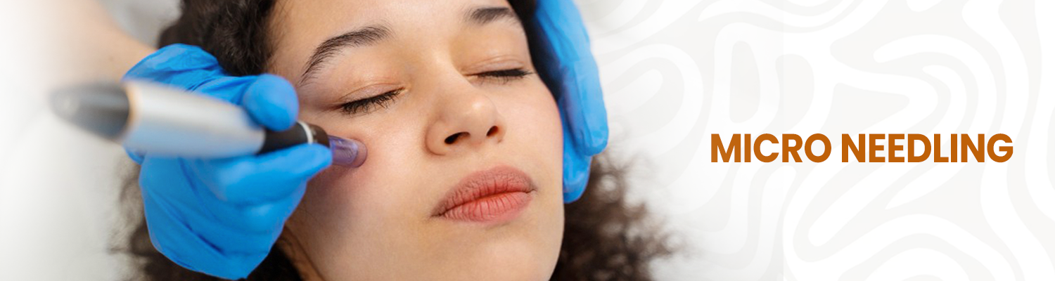 Micro needling
