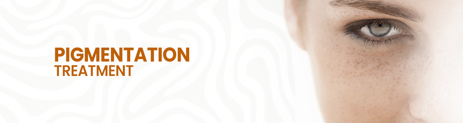 Pigmentation Treatment